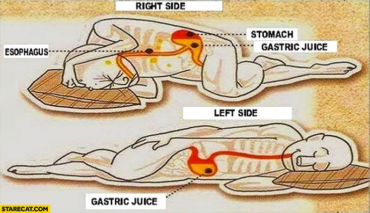 sleeping-on-the-left-side-vs-right-side-gastric-juice-stomach-esophagus.jpg